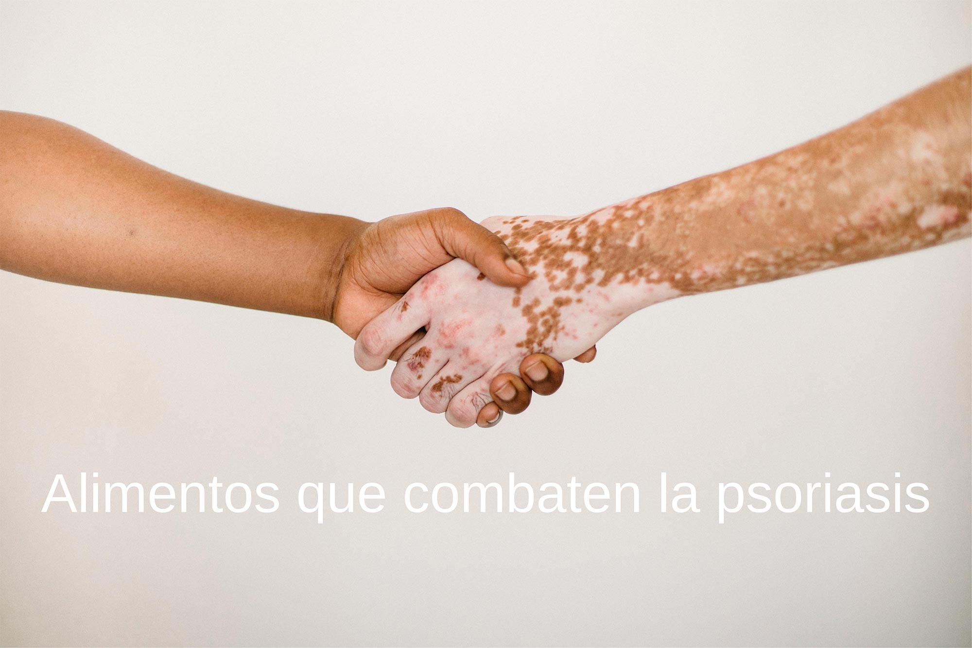 Alimentos-que-combaten-la-psoriasis_S